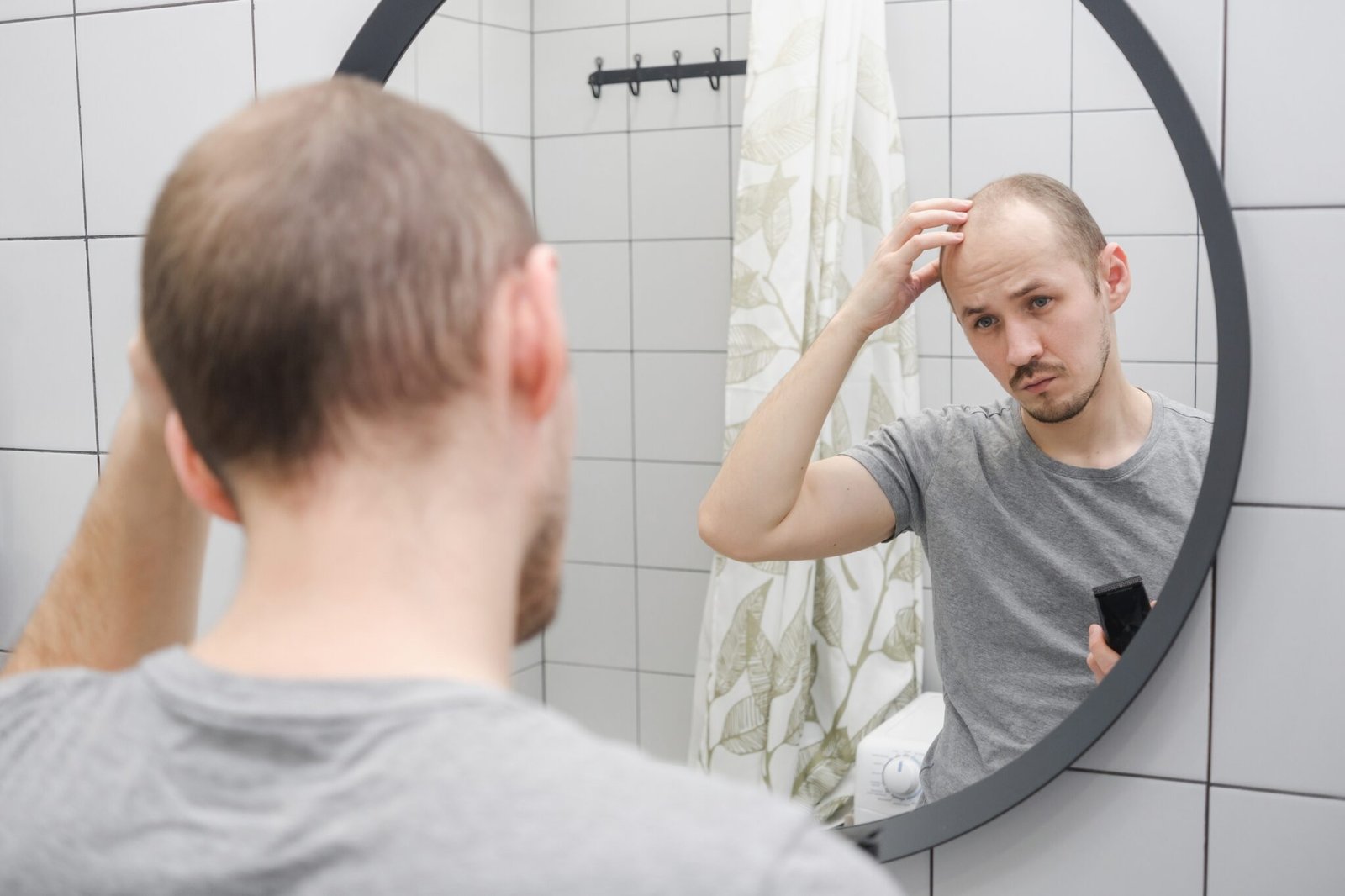 an upset man with hair loss problem looking at mir 2024 10 11 21 45 15 utc